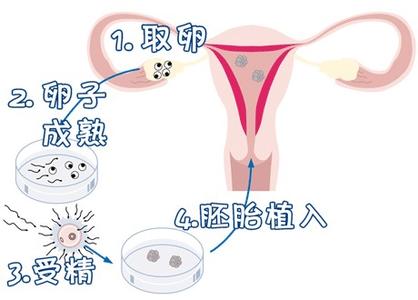 生殖妇科